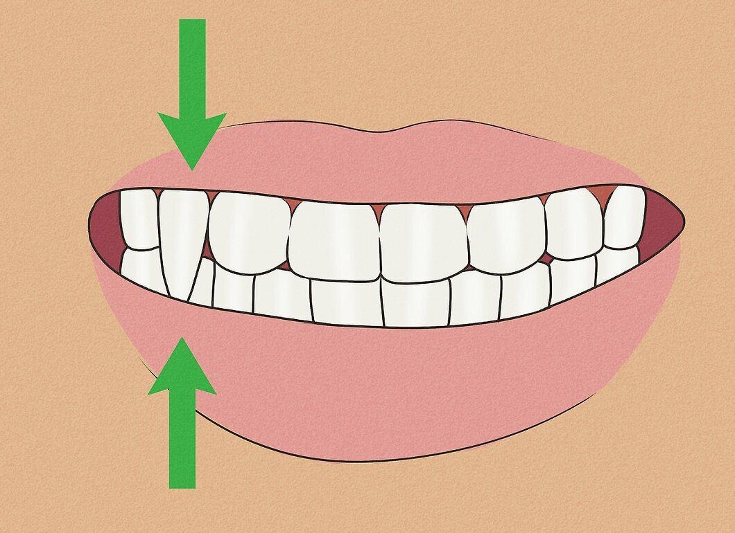 Step 3