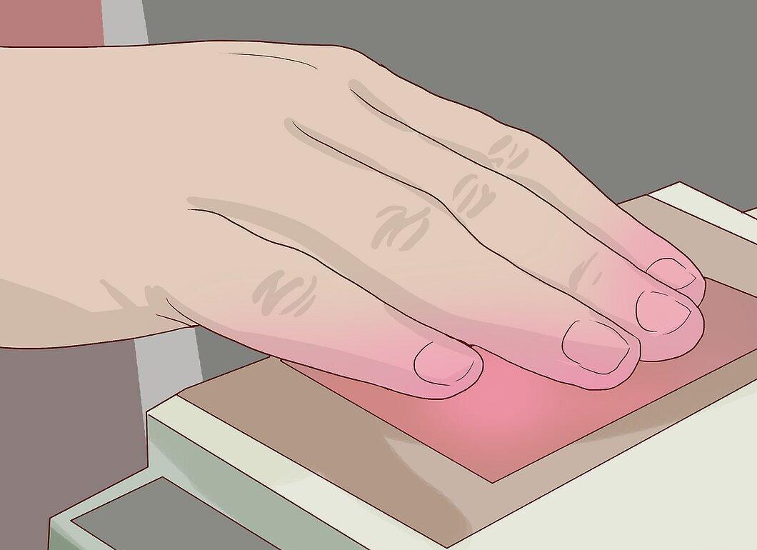 Step 5